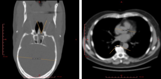 ../_images/mri-2d.jpg